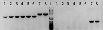 The Metabolism of Clostridium ljungdahlii in Phosphotransacetylase Negative Strains and Development of an Ethanologenic Strain